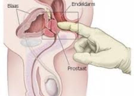 A prosztatagyulladás csökkent libidót - Prostatitis nem libidó