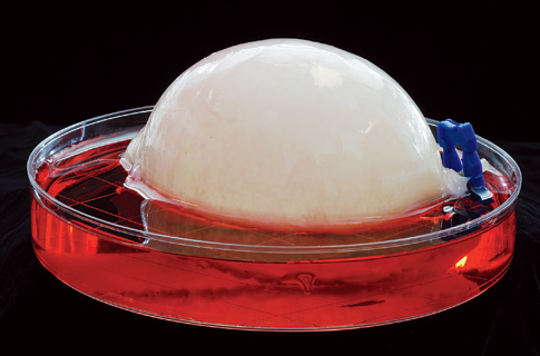 Artificial bladder made from human cells. - Mediamatic